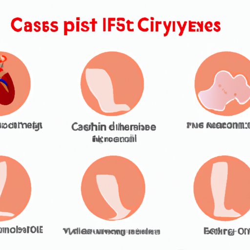 II. Causes and Risk Factors for Cysts: A Comprehensive Guide