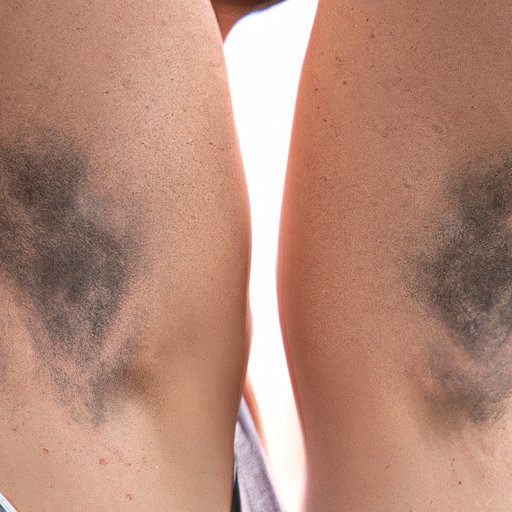  The Impact of Shaving and Using Deodorants on Dark Armpits 