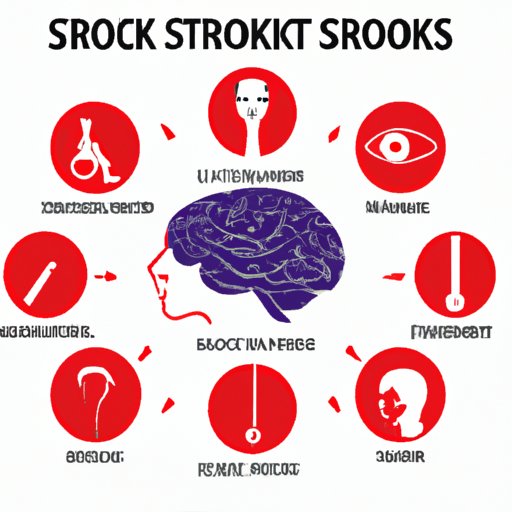 Everything You Need to Know About Symptoms of Stroke: A Comprehensive Guide