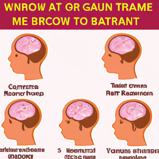 How to Recognize the Signs of a Brain Tumor