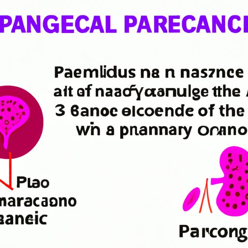 VIII. The Importance of Recognizing Early Symptoms of Pancreatic Cancer