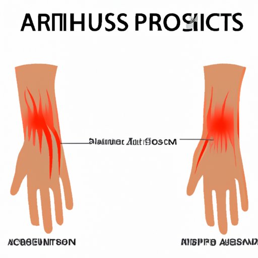 The Link Between Skin Rashes and Joint Pain: Understanding Psoriatic Arthritis Symptoms