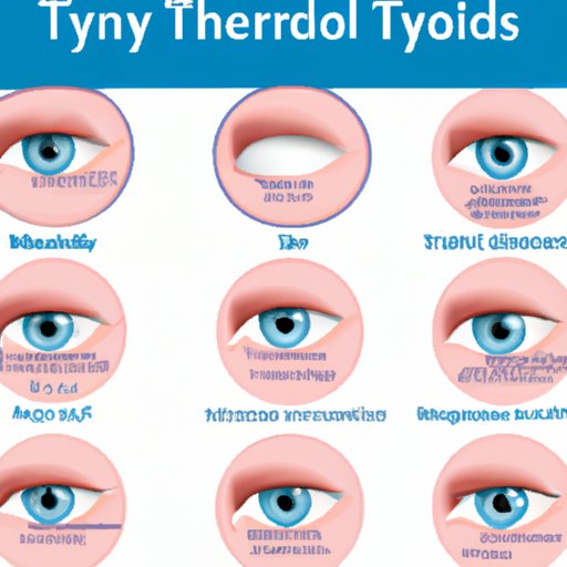 VII. How to Recognize Thyroid Eye Disease: A Comprehensive Guide to Identifying Symptoms