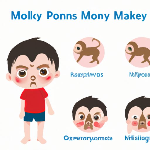 Protecting Yourself from Monkey Pox: Early Detection and Symptom Identification