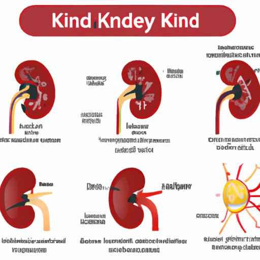 understanding-stage-2-kidney-disease-symptoms-causes-treatment-and